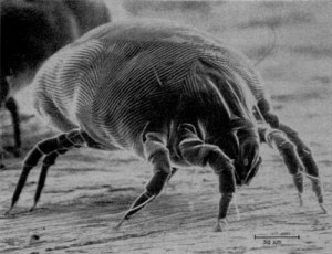 Photo of How to Get Rid of Dust Mites